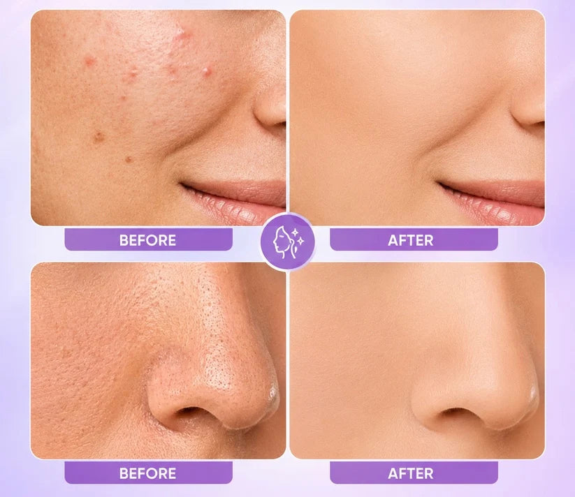 🔥Final 3 Hours Buy 1 Get 1 FREE✨Perfect Complexion Express Matte Cream